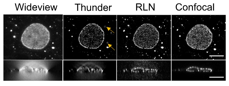 A series of four blurry circles that get progressively clearer with the text, "wideview", "thunder", "RLN" and "Confocal"