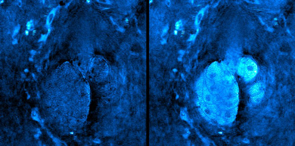 STRIDE image of glucose incorporated into sebaceous glands in the skin of a live mouse 