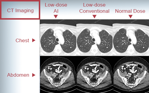 Abdominal and chest CT images on chart