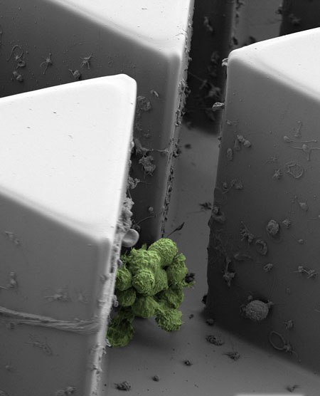 Image of magnified circulating tumor cell cluster