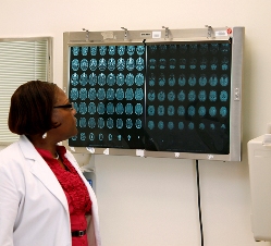 Esta es una foto de un médico observando imágenes de TC secuenciales del cerebro en un lector de rayos X  