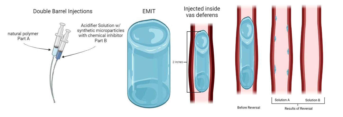 A series of three images including a diagram of two syringes with light and dark blue liquid, a diagram of a blue cylinder shown inside and outside of the vas deferens, and a diagram showing two versions of the vas deferens with only traces of the blue cylinder left.