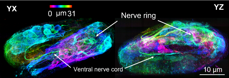 two views of developing embryo of the round worm