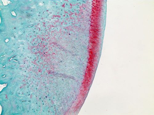 Microscopy image showing cartilage regeneration