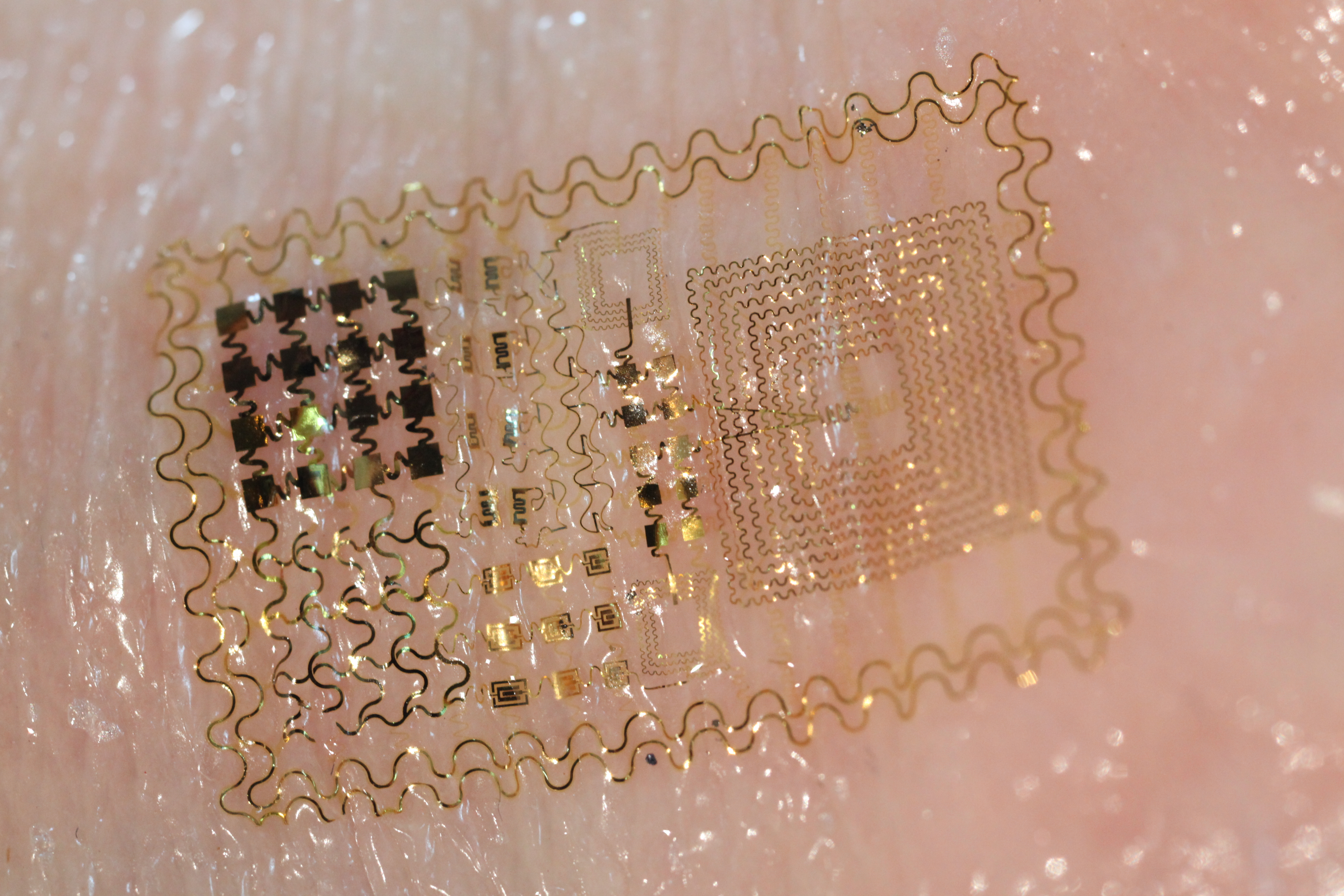 Image of flexible temperature sensor laminated to the surface of the skin