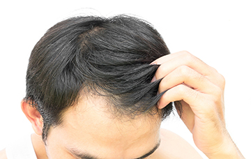 man running fingers through hair