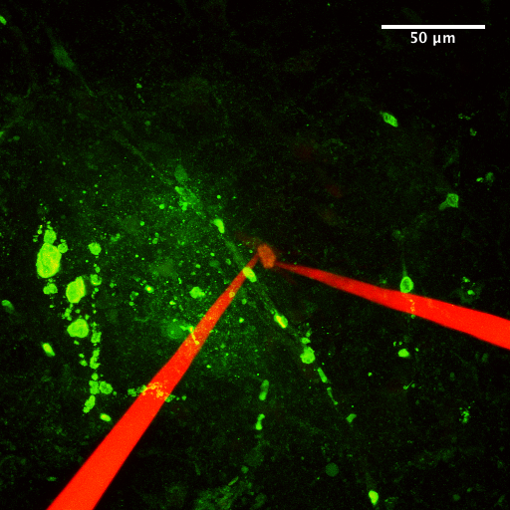 Two patch-clamps performed on same neuron