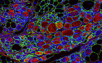 Muscle cells stained with fluorescent molecules