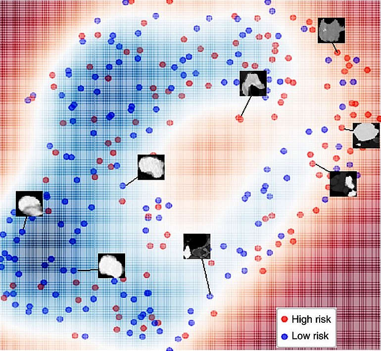 2D representation of LungNet identification of high and low risk lung nodules