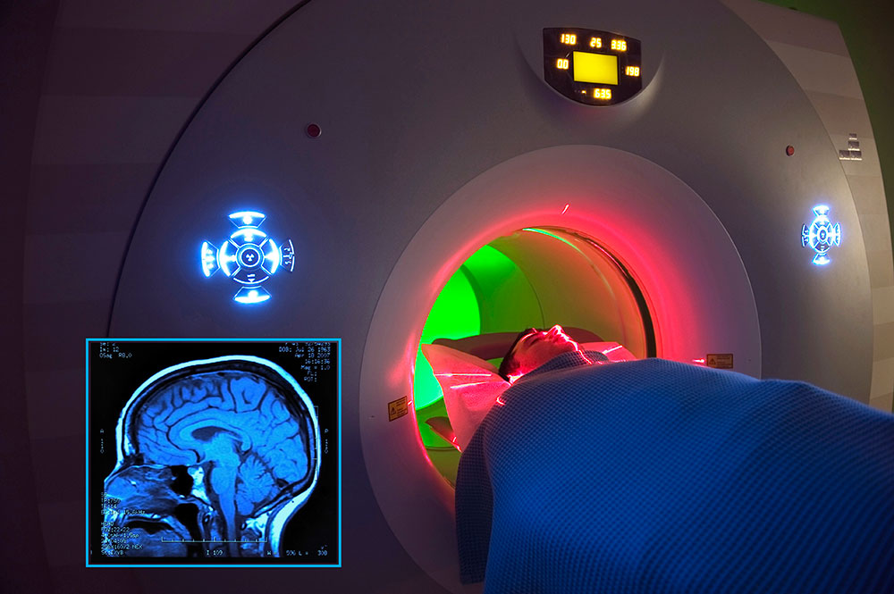 MRI procedure photo