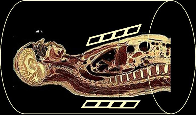Imagen por IRM de la parte superior del cuerpo y la cabeza de una persona