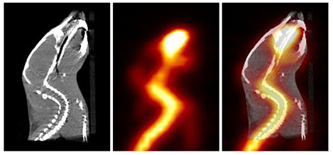 A series of images, CT on the left, PET in the middle and a combination PET/CT on the right.