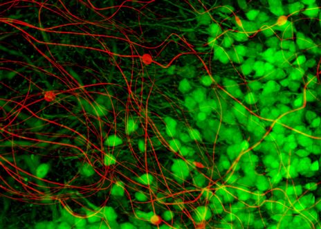 Neuron-like electronics mingles with neurons in mouse brain