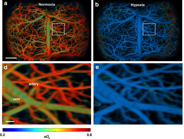 Four images of the brain, two red and green and two blue