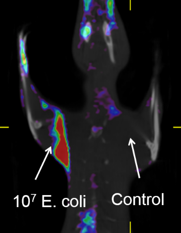 Escaneo tomografía por emisión de positrones usando un agente de contraste para mostrar la bacteria E. coli en una rata