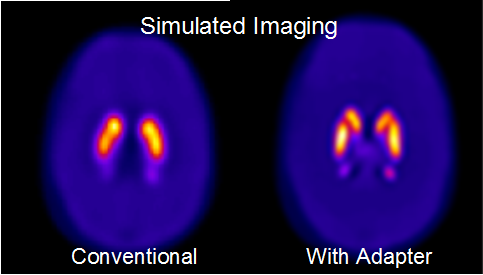 Escaneo del cerebo simulado usando tomografía computarizada por emisión de fotón único en comparación con un escaneo usando esta tecnología con un adaptador que proporciona una imagen más detallada de un cerebro afectado con la enfermedad de Parkinson