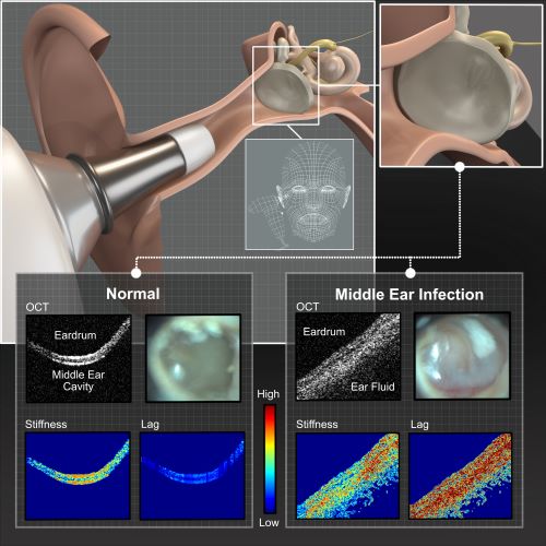 Illustration of instrumentation being used to make a middle ear infection diagnosis