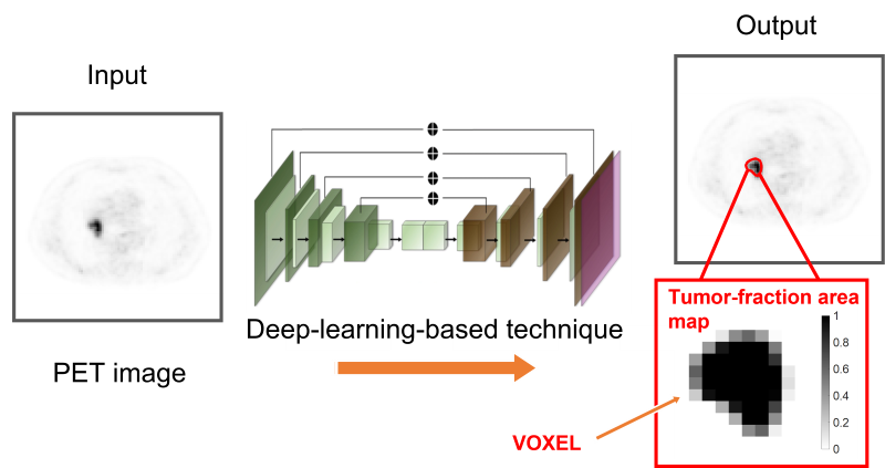 deep learning scheme to define tumors in PET images