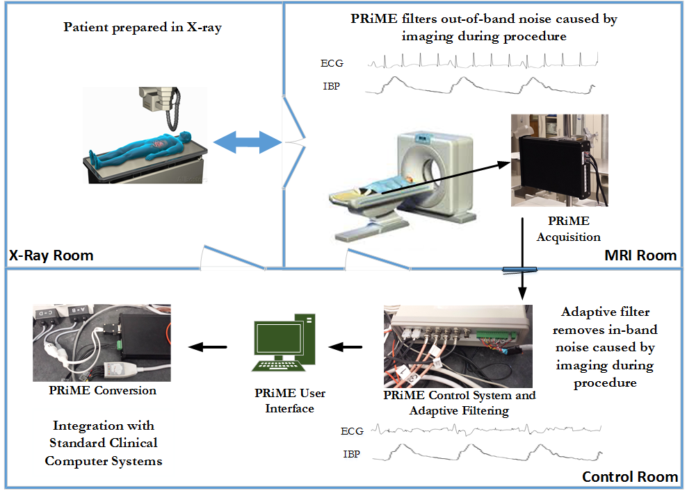 Workflow of the PRiME system.