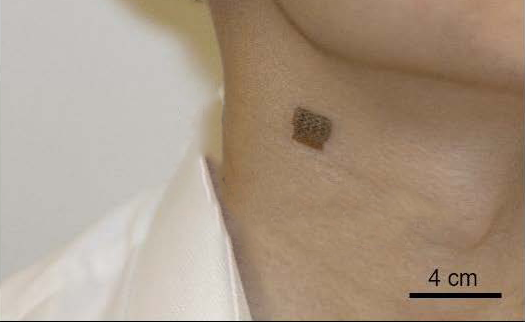 Small, wearable patch placed on neck measures central blood pressure in the carotid artery.