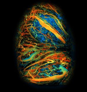Photoacoustic microscopy image of a mouse placenta