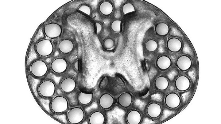 3D printed spinal implant