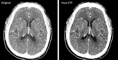 computed tomography of brain vs reconstructed brain image 