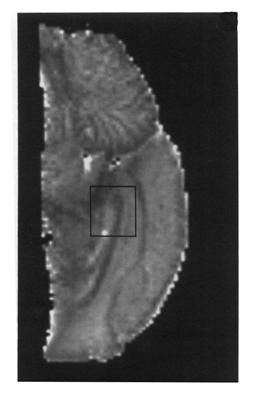 Diffusion tensor MRI of cat brain