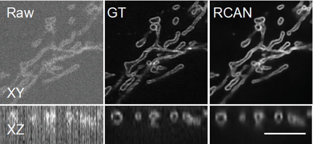 DENOISING. Images of the outer mitochondrial membrane of a cell are difficult to see because of the very low signal to noise ratio (SNR) in the left (Raw) image. Using high power, a much clearer image (known as the ground truth or GT image) can be obtained. At the far right is the image created by the RCAN network, which was shown the raw image and predicted the sharper image. Scale bar = 5 micrometers.