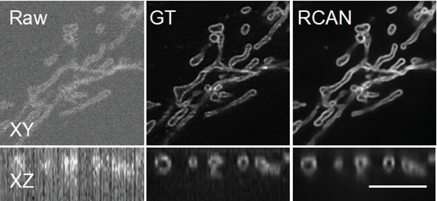 mitochondrial membrane image with AI resolution