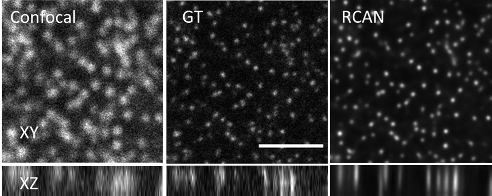 DEBLURRING. Images of nuclear pores created with diffraction-limited confocal microscope (left) are blurry. Using a super-resolution microscope the nuclear pores are much better resolved (GT, ground truth image).  At the far right the RCAN network was shown the blurry confocal image and predicted the sharp image, which much better resembles the high resolution GT image. Scale bar = 5 micrometers.