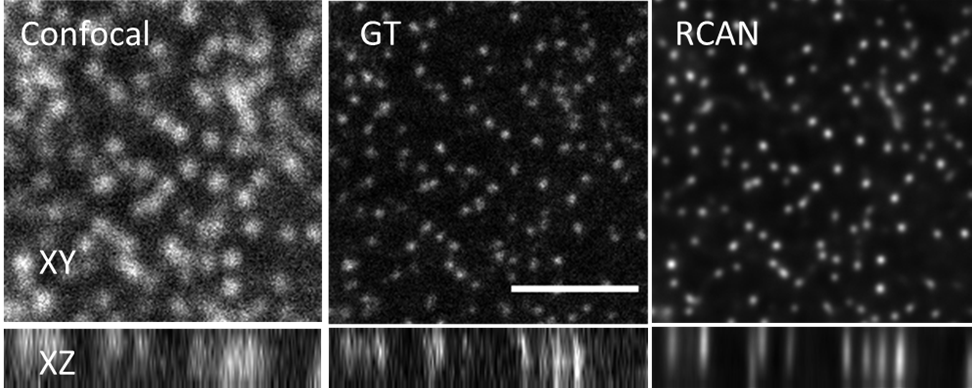 image of cell nuclear pores