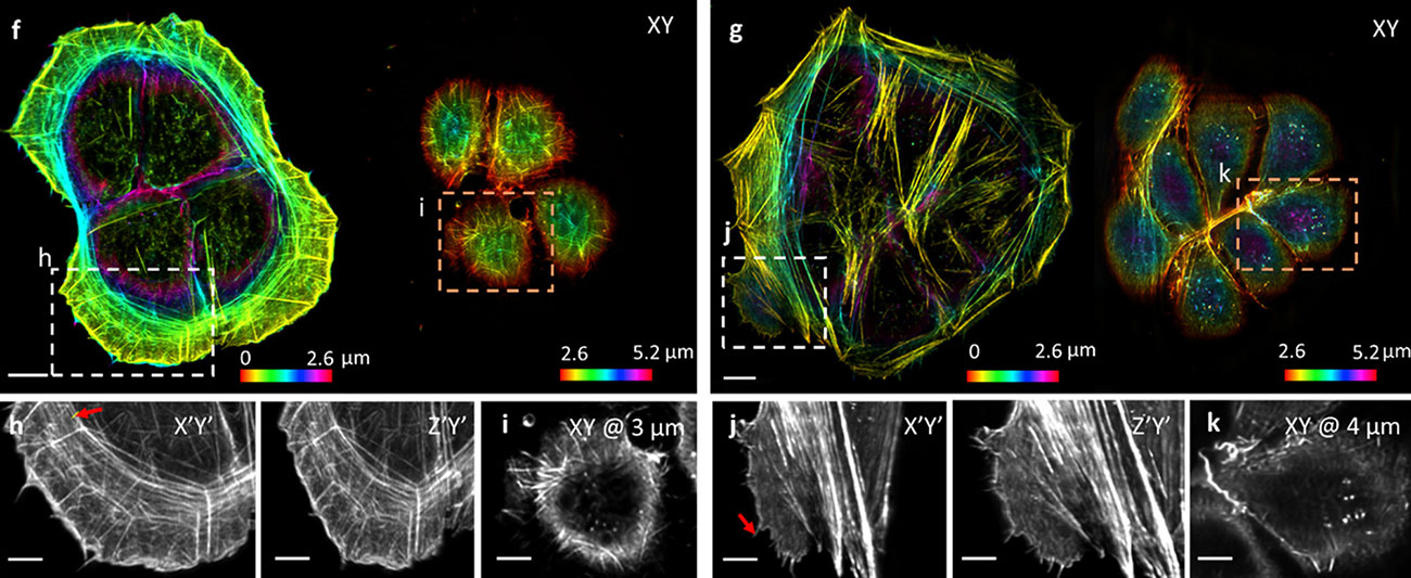 Multiple images, both in color and black and white, of cellular structures.