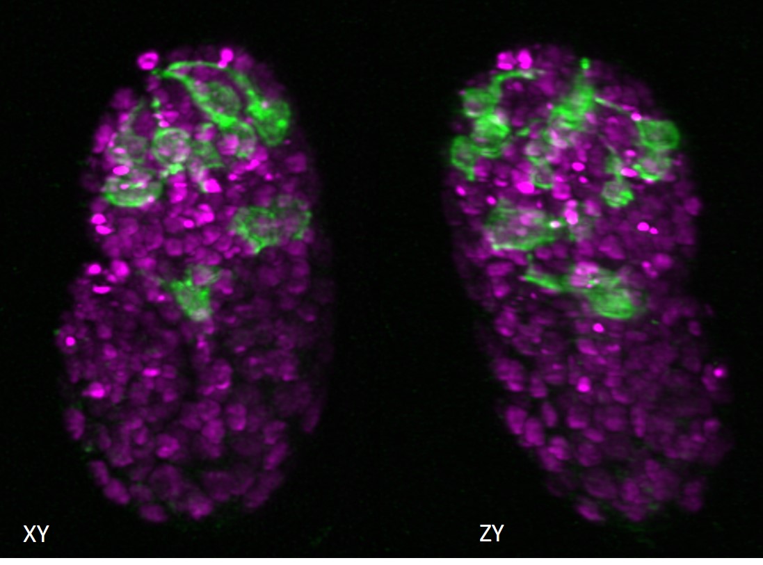 Two views of a C. elegans embryo. The green fluorescence shows the neurons and the magenta areas are the nuclei of the cells.