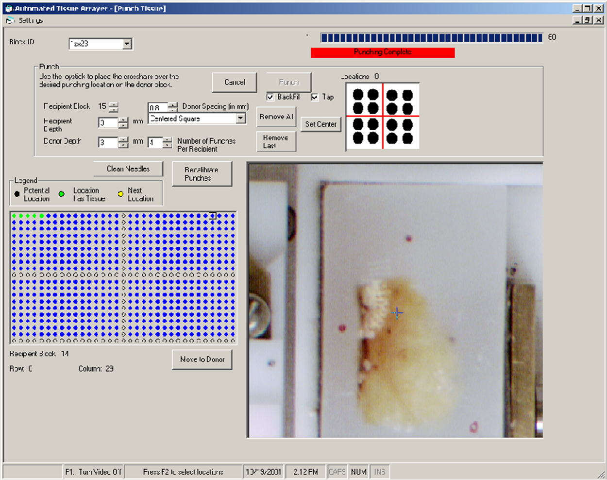 Robotic TMA control software