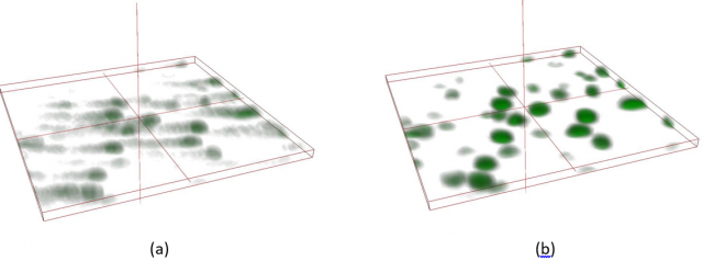 Time-lapse volume of with and without motion tracking correction