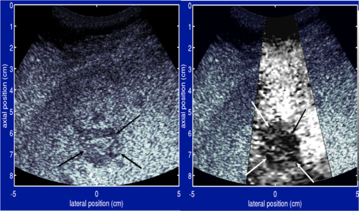 https://www.nibib.nih.gov/sites/default/files/inline-images/Ultrasound-sp4_1.jpg