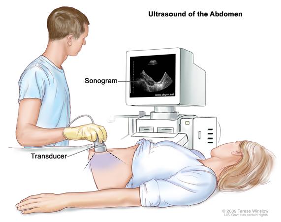 This is a picture of a technician giving a pregnant woman an ultrasound. There is an image of the fetus on the computer monitor.