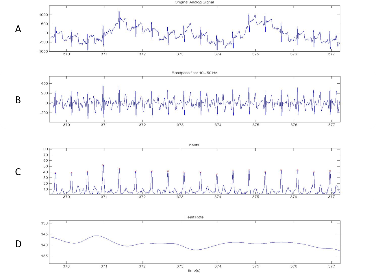 Example of ECG signal processing