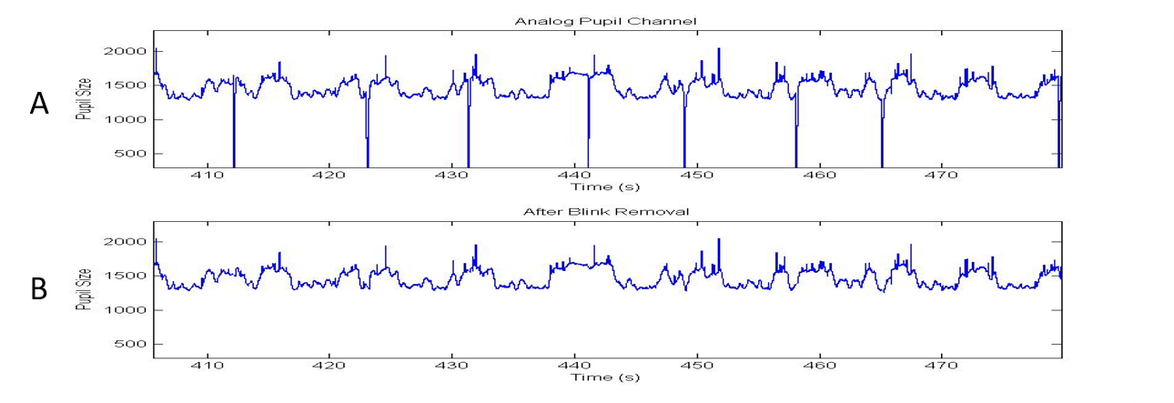 Example of pupil data processing