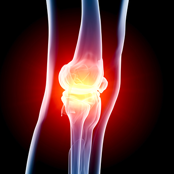 x-ray image of a patient's knee