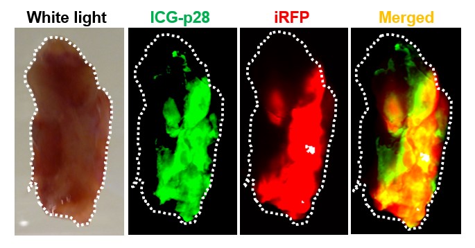 Four panels with an excised tumor surrounded by dotted lines. The first panel shows the excised tumor as it would appear under white light. The second panel shows green fluorescence and is labeled ICG-p28. The third panel shows red fluorescence and is labeled iRFP. The fourth panel has merged red and green fluorescence and is labeled merged.