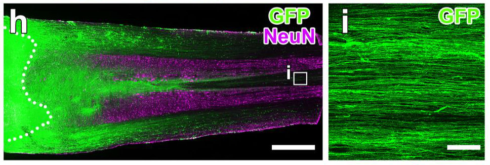 Neural stem cells differentiate in rat spinal injury model