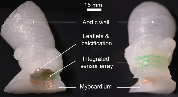 Modelo impreso en 3D de la aorta del paciente