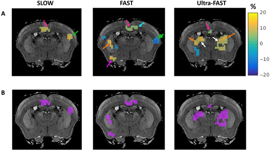 stiffness differences after stimulus using fMRE