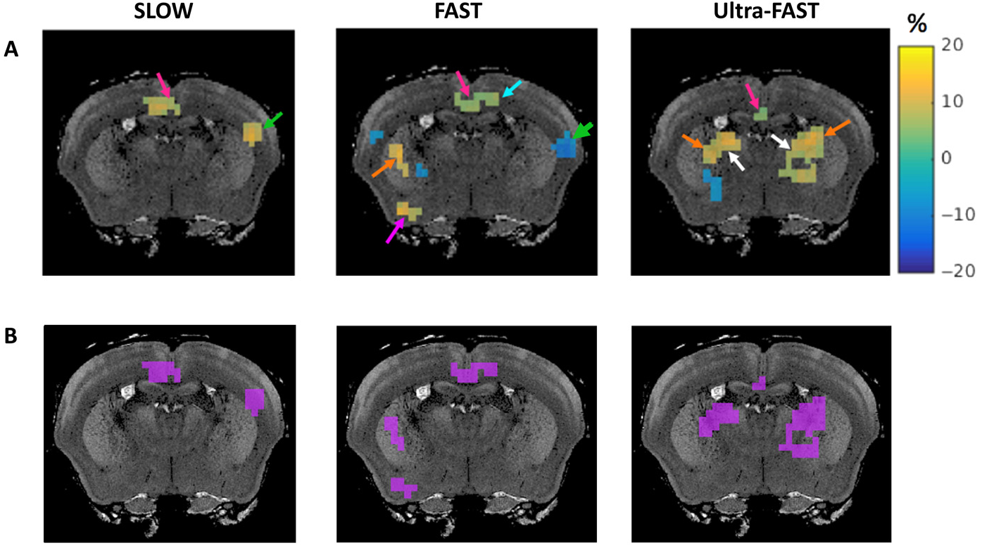 stiffness differences after stimulus using fMRE