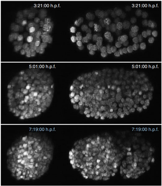 Dual view example of DISPIM microsope