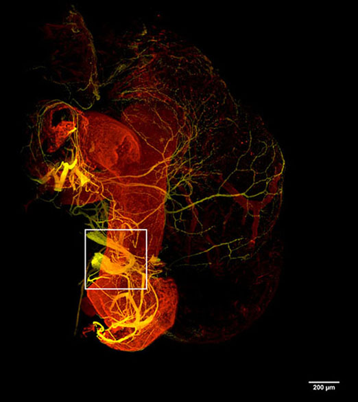 Dual view image of cleared mouse heart