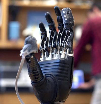 Prosthetic hand with e-dermis on thumb and forefinger