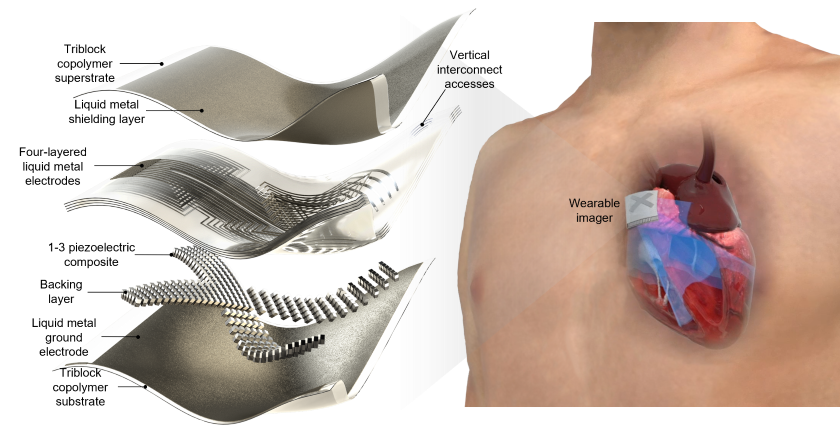 Exploded view of a wearable ultrasound patch, about the size of a postage stamp